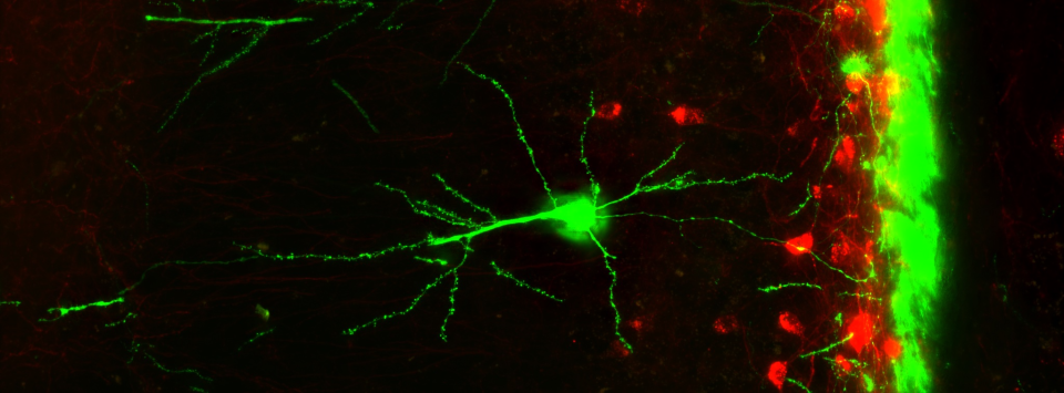 GFP-labeled excitatory pyramidal neuron cell bodies and processes (green) interacting with mCherry